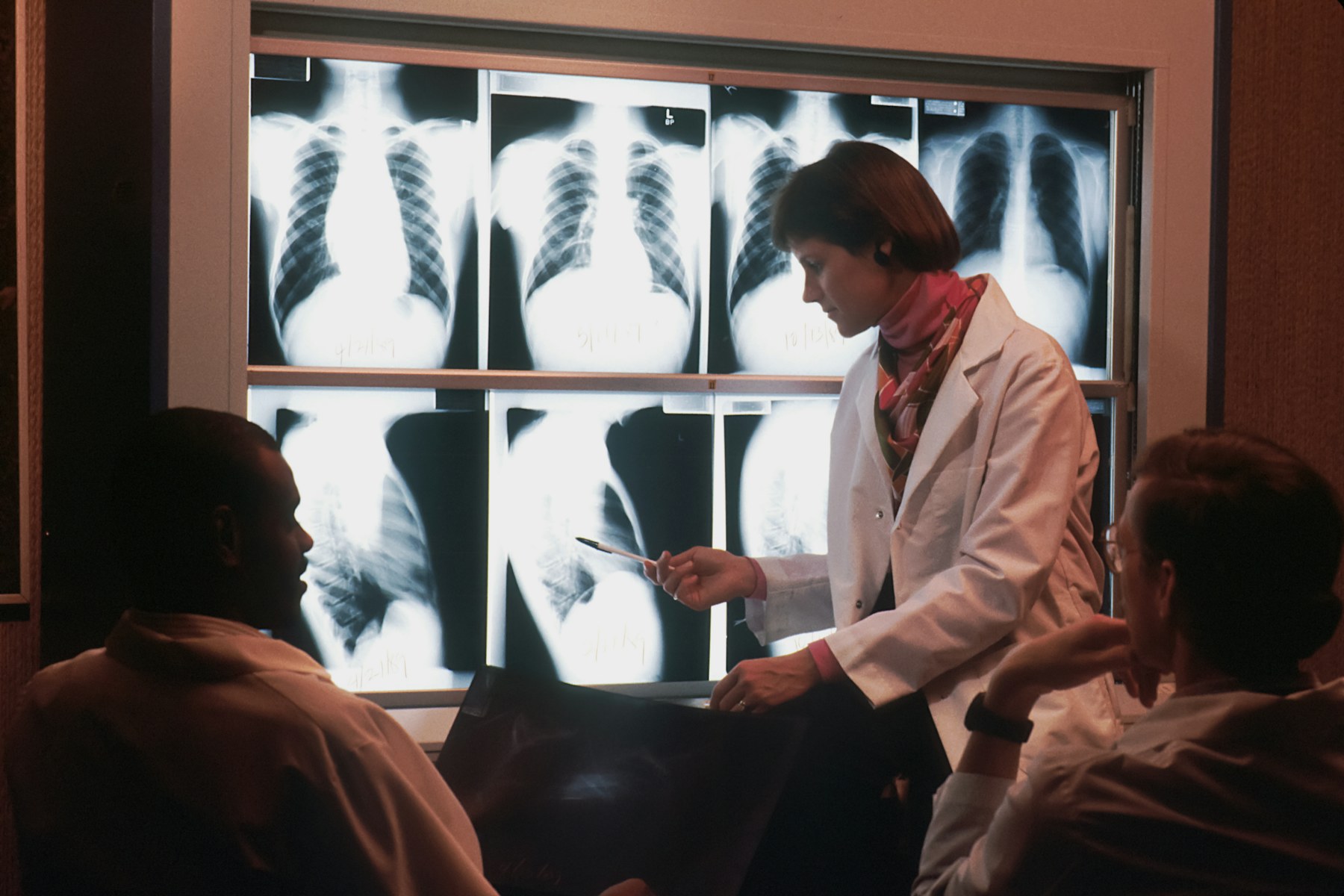 A radiologist discusses chest X-rays with two people.